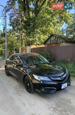 Седан Acura ILX 2015 в 