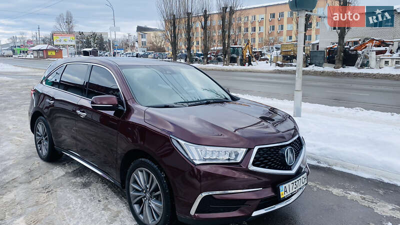 Позашляховик / Кросовер Acura MDX 2017 в Вишгороді фото 3 Позашляховик / Кросовер Acura MDX 2017 в Вишгороді
