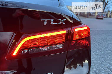 Седан Acura TLX 2017 в Фастове