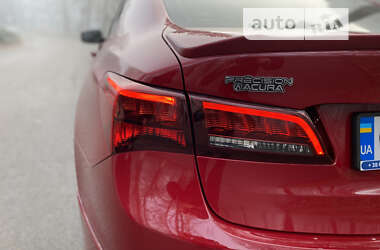 Седан Acura TLX 2017 в Черновцах