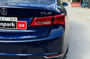 Седан Acura TLX 2017 в Києві