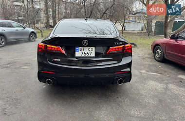 Седан Acura TLX 2017 в Кременчуці