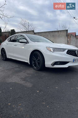 Седан Acura TLX 2018 в Киеве