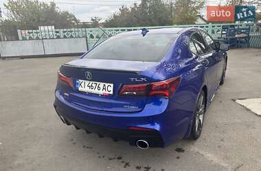 Седан Acura TLX 2018 в Києві