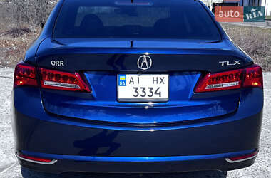 Седан Acura TLX 2017 в Киеве