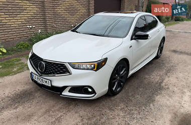 Седан Acura TLX 2017 в 