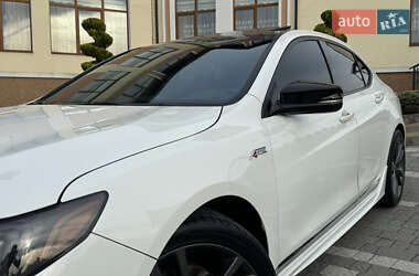 Седан Acura TLX 2018 в 