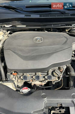 Седан Acura TLX 2015 в 