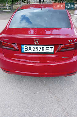 Седан Acura TLX 2016 в 