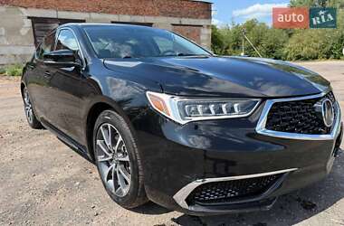 Седан Acura TLX 2017 в Житомирі