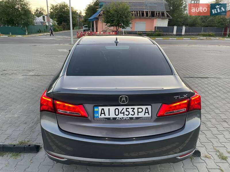 Седан Acura TLX 2017 в Киеве фото 5 Седан Acura TLX 2017 в Киеве