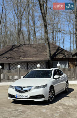 Седан Acura TLX 2016 в Житомире Седан Acura TLX 2016 в Житомире