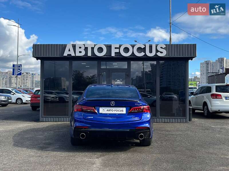 Седан Acura TLX 2018 в Киеве фото 6 Седан Acura TLX 2018 в Киеве