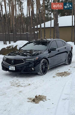 Седан Acura TLX 2018 в Житомире