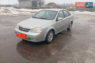 Седан Chevrolet Lacetti 2004 в Прилуках