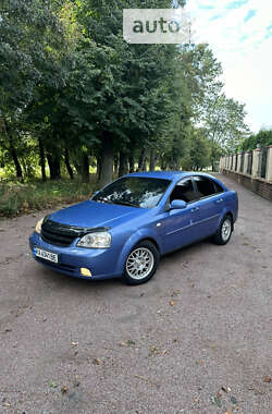 Седан Chevrolet Lacetti 2007 в Василькові