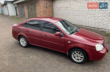 Седан Chevrolet Lacetti 2008 в Житомирі