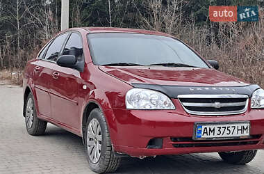 Седан Chevrolet Lacetti 2006 в Житомире