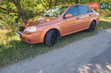 Седан Chevrolet Lacetti 2006 в Бердичеве