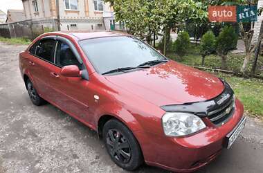 Седан Chevrolet Lacetti 2005 в Козятині