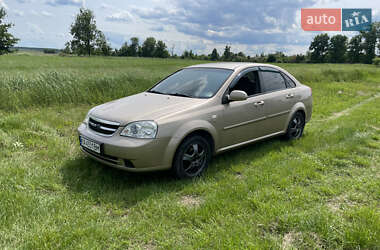 Седан Chevrolet Lacetti 2006 в Буче