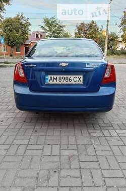 Седан Chevrolet Nubira 2005 в Житомирі