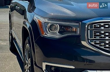 Позашляховик / Кросовер GMC Acadia 2017 в Києві фото 3 Позашляховик / Кросовер GMC Acadia 2017 в Києві