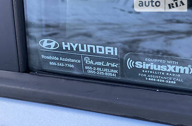 Хетчбек Hyundai Accent 2014 в Умані