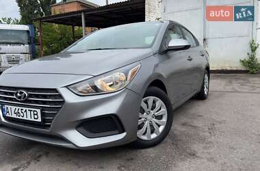 Седан Hyundai Accent 2021 в Белой Церкви