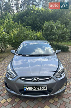 Хэтчбек Hyundai Accent 2017 в Киеве