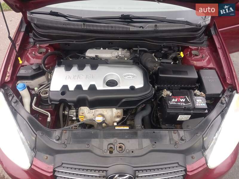 Седан Hyundai Accent 2007 в Сребном фото 18 Седан Hyundai Accent 2007 в Сребном