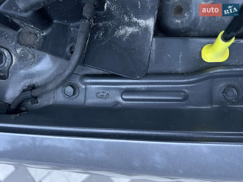 Седан Hyundai Accent 2011 в Ніжині фото 36 Седан Hyundai Accent 2011 в Ніжині