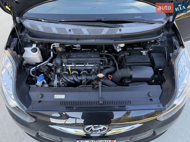 Хэтчбек Hyundai ix20 2010 в Луцке фото 34 Хэтчбек Hyundai ix20 2010 в Луцке