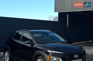 Внедорожник / Кроссовер Hyundai Kona 2018 в Виннице