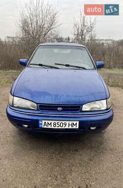 Седан Hyundai Lantra 1992 в Овручі
