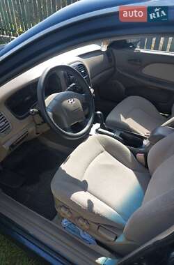 Седан Hyundai Sonata 2004 в Житомире