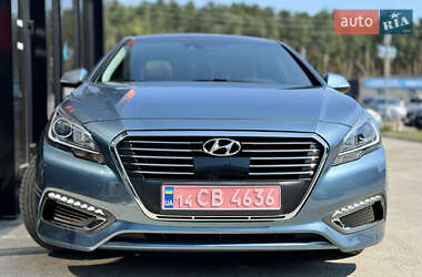 Седан Hyundai Sonata 2016 в Киеве