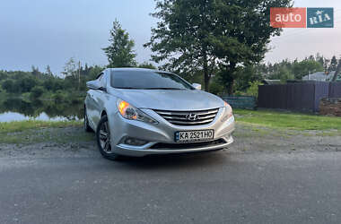 Седан Hyundai Sonata 2014 в Житомирі