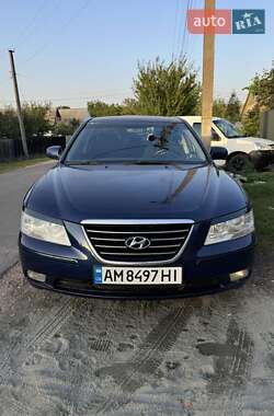 Седан Hyundai Sonata 2008 в Житомире