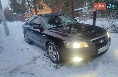 Седан Hyundai Sonata 2006 в Житомирі