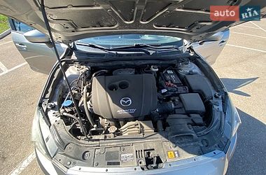 Хетчбек Mazda 3 2016 в Житомирі фото 26 Хетчбек Mazda 3 2016 в Житомирі